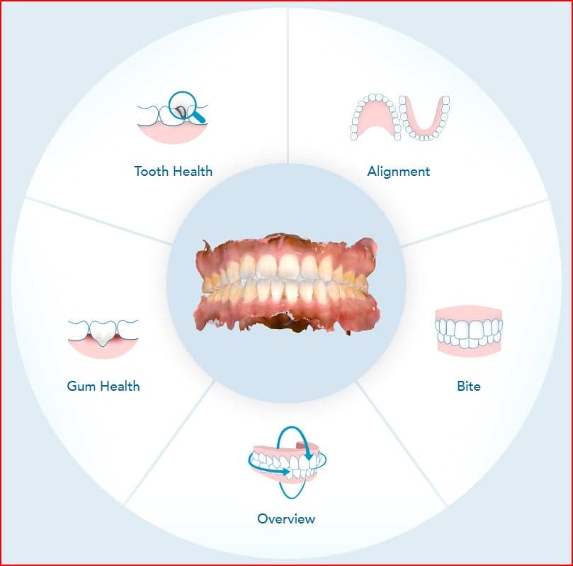 iTero Lumina 3D scan health suite — tooth health, alignment, gum health, bite, and full-arch overview